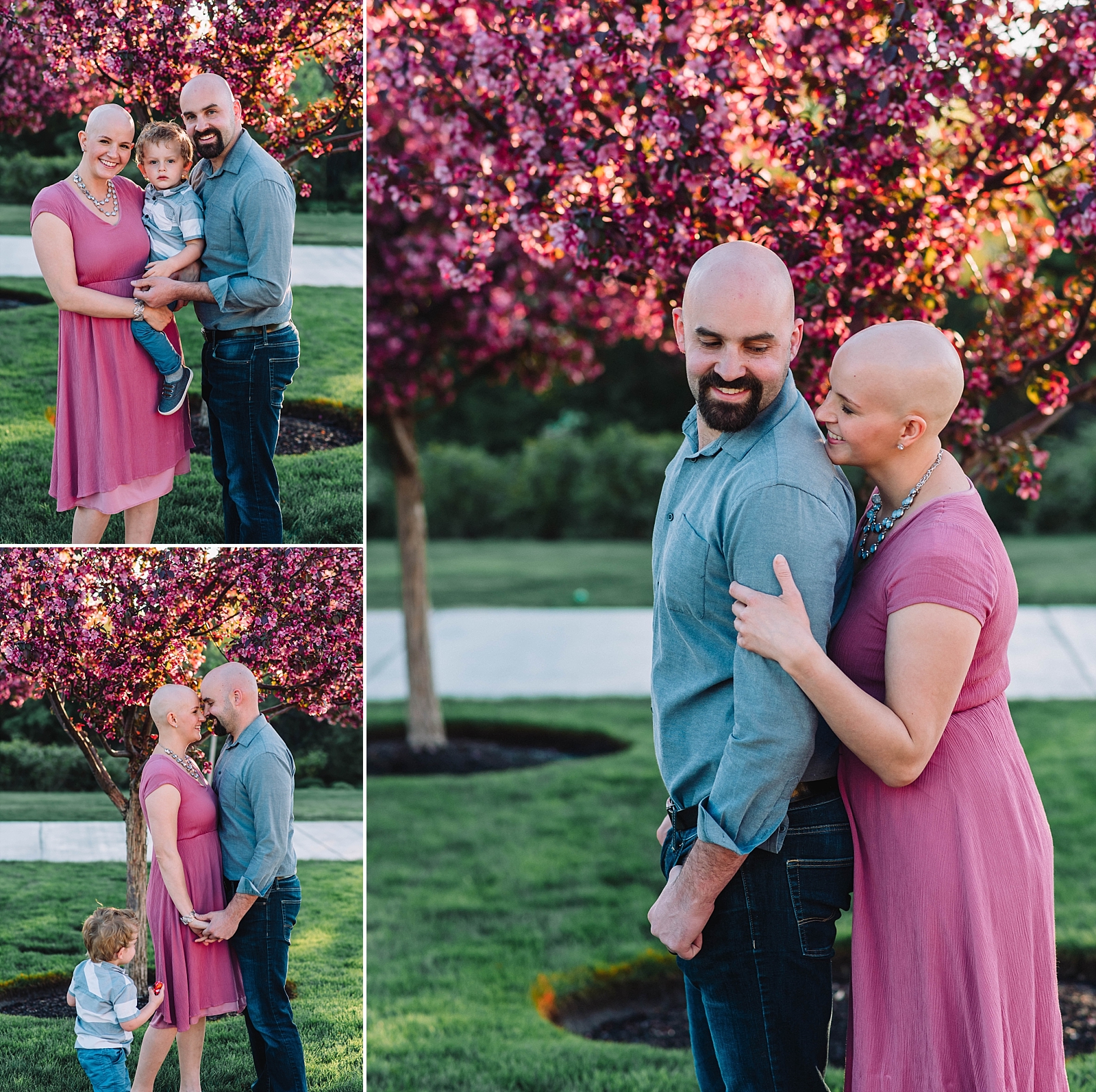 bald beauty breast cancer survivor and family
